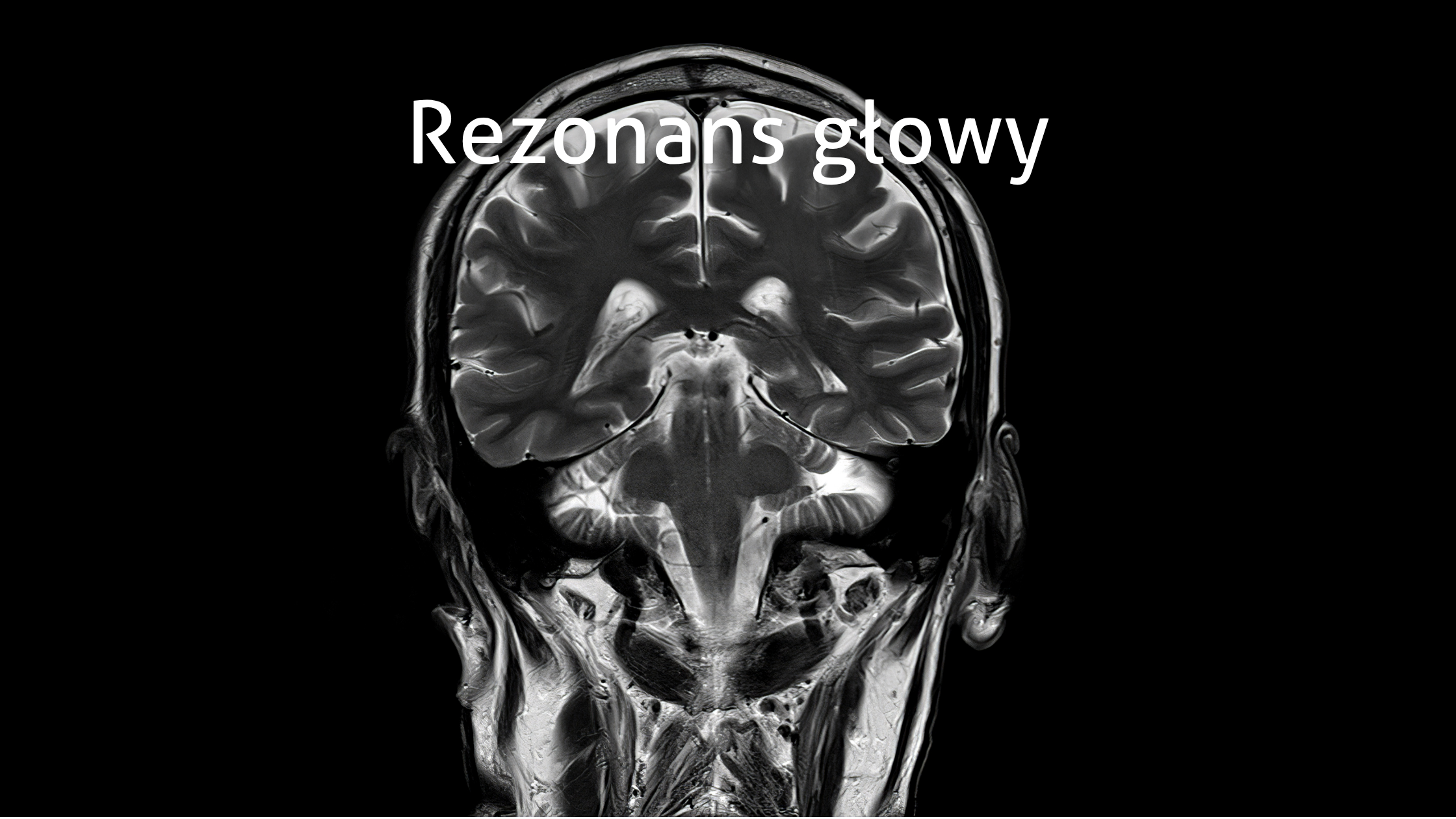Rezonans magnetyczny głowy. Kiedy warto wykonać badanie i co może wykryć